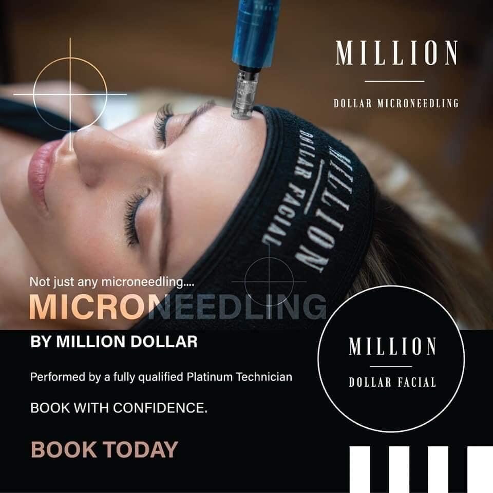 microneedling-chepstow